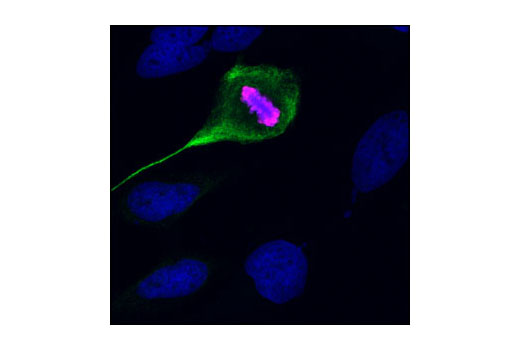 Immunofluorescence Image 1: Phospho-Vimentin (Ser56) Antibody