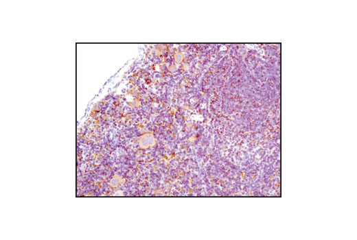  Image 14: Mouse Reactive Alzheimer's Disease Model Microglia Phenotyping IF Antibody Sampler Kit