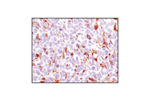  Image 23: Mouse Reactive Alzheimer's Disease Model Microglia Phenotyping IF Antibody Sampler Kit