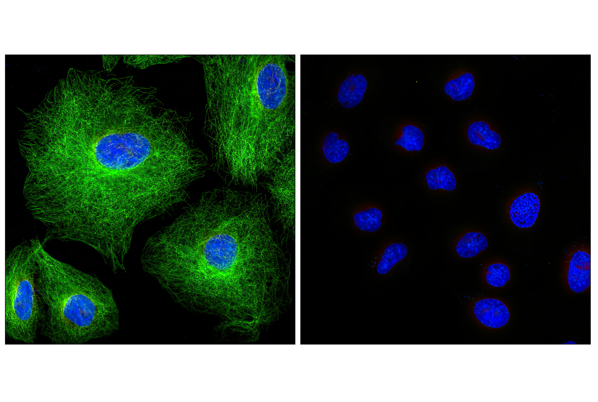 Immunofluorescence Image 1: Rabbit (DA1E) mAb IgG XP® Isotype Control