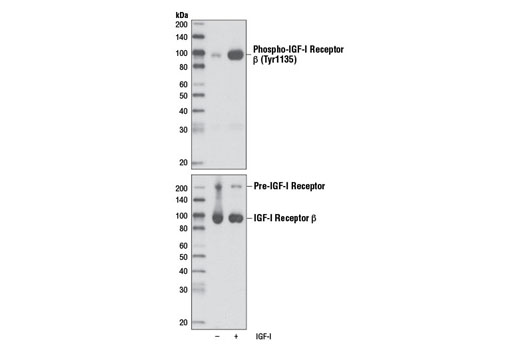  Image 5: Phospho-Insulin/IGF Receptor Antibody Sampler Kit