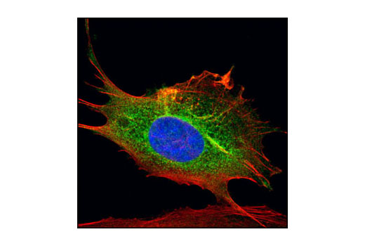 Immunofluorescence Image 1: PKA RI-α/β Antibody