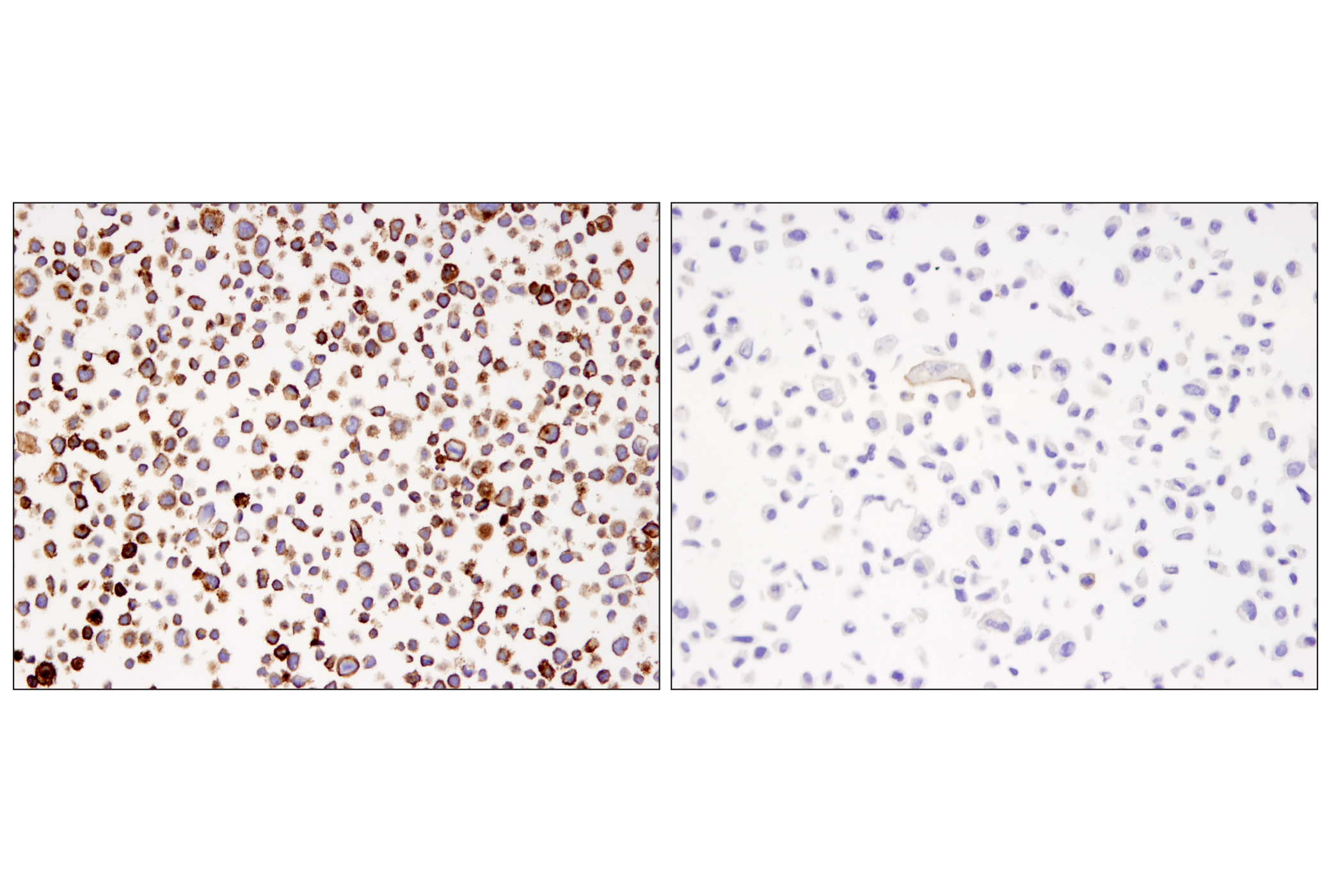 Immunohistochemistry Image 1: PD-L1 (405.9A11) Mouse mAb (BSA and Azide Free)