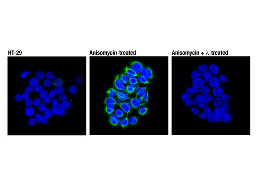 Immunofluorescence Image 1: Phospho-Keratin 20 (Ser13) (D9M6O) Rabbit mAb