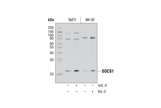 Western Blotting Image 1: SOCS1 (A156) Antibody