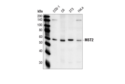 Western Blotting Image 1: MST2 Antibody