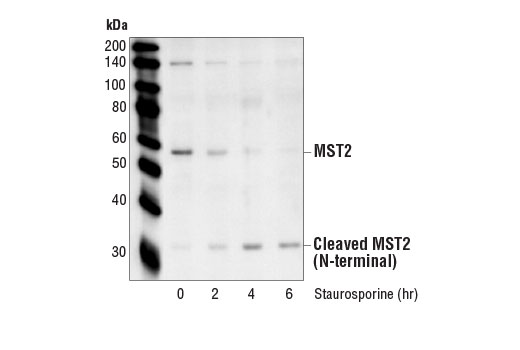 Western Blotting Image 2: MST2 Antibody