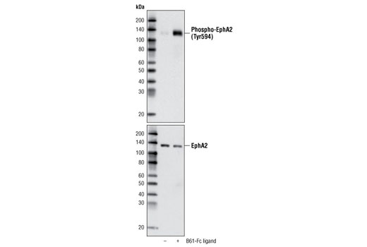 Western Blotting Image 1: Phospho-EphA2 (Tyr594) Antibody