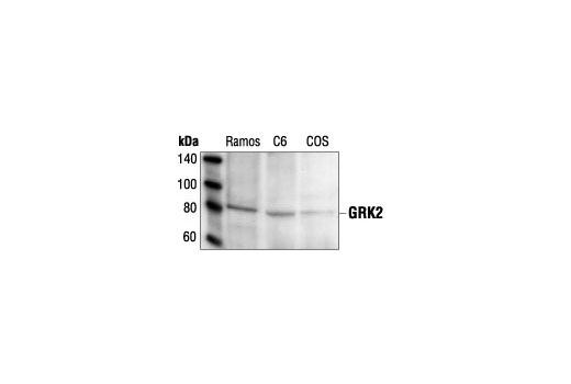 Immunoprecipitation Image 1: GRK2 Antibody