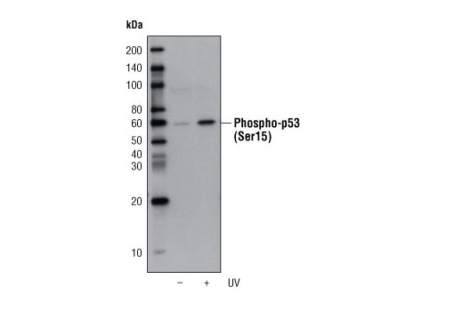 Western Blotting Image 1: Phospho-p53 (Ser15) (16G8) Mouse mAb (Biotinylated)