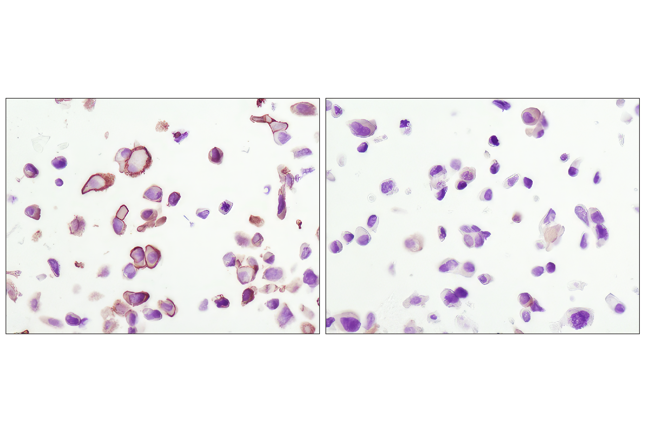  Image 26: AS160 Signaling Antibody Sampler Kit