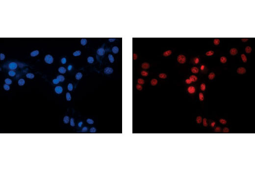 Immunofluorescence Image 1: Pan-Methyl-Histone H3 (Lys9) Antibody