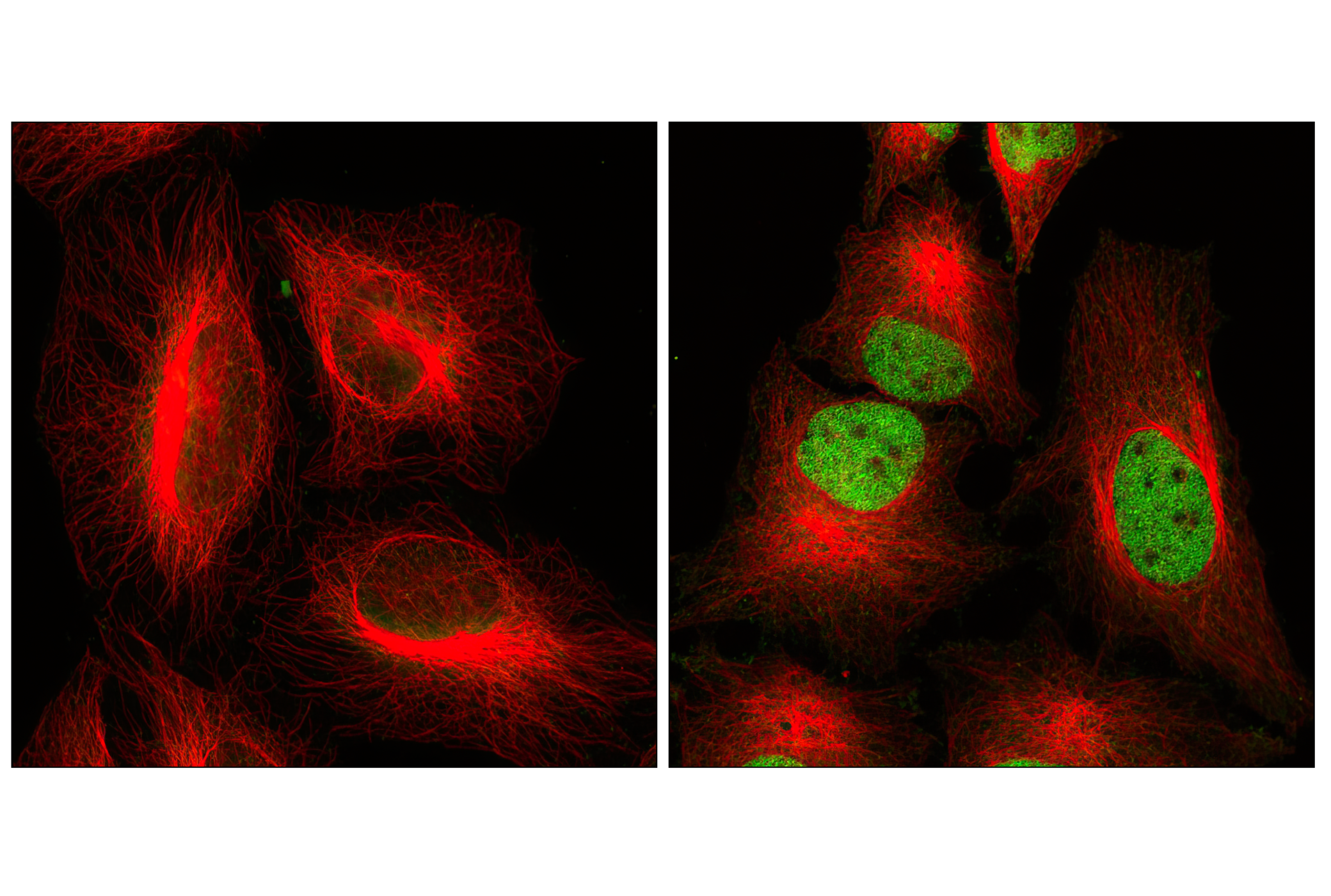 Immunofluorescence Image 1: Phospho-Stat3 (Tyr705) (M9C6) Mouse mAb
