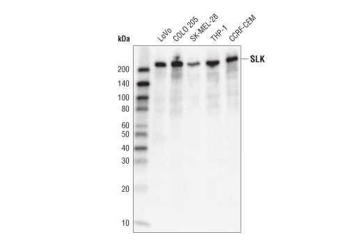 Western Blotting Image 1: SLK Antibody