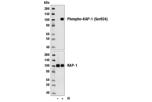 Western Blotting Image 1: Phospho-KAP-1 (Ser824) Antibody