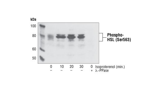  Image 5: Lipolysis Activation Antibody Sampler Kit