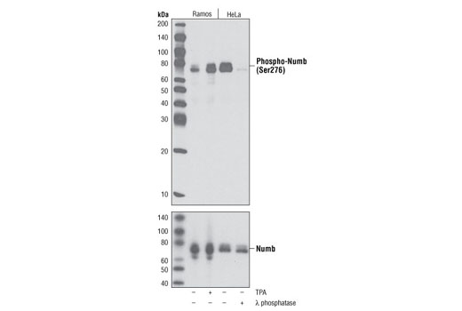 Western Blotting Image 1: Phospho-Numb (Ser276) Antibody