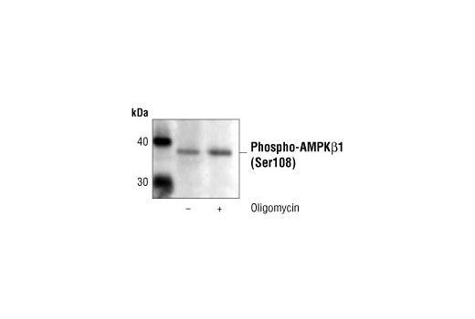 Immunoprecipitation Image 1: Phospho-AMPKβ1 (Ser108) Antibody