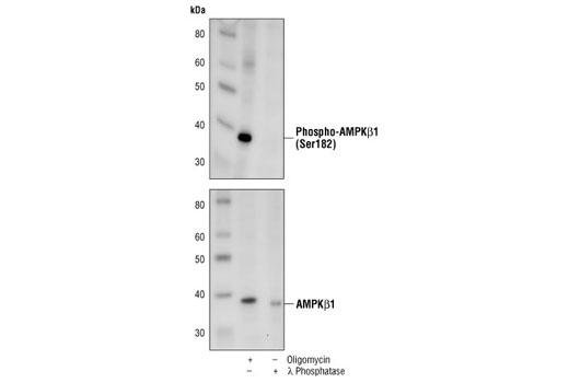  Image 7: AMPK and ACC Antibody Sampler Kit