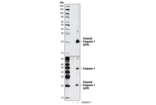  Image 10: Human Reactive Inflammasome Antibody Sampler Kit II