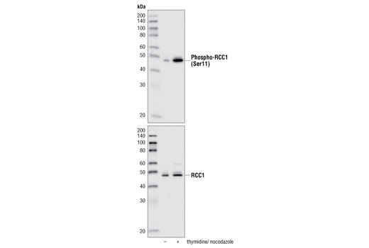 Western Blotting Image 1: Phospho-RCC1 (Ser11) Antibody
