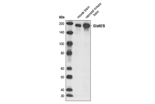 Western Blotting Image 1: NMDA Receptor 2B (GluN2B) (D15B3) Rabbit mAb