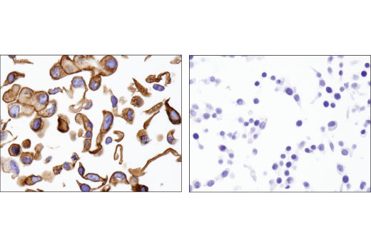 Immunohistochemistry Image 3: NaPi2b/SLC34A2 (D6W2G) Rabbit mAb