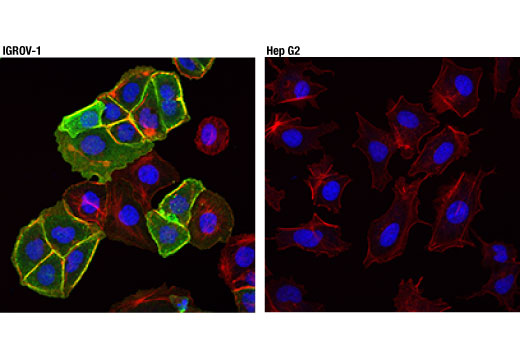 Immunofluorescence Image 1: NaPi2b/SLC34A2 (D6W2G) Rabbit mAb
