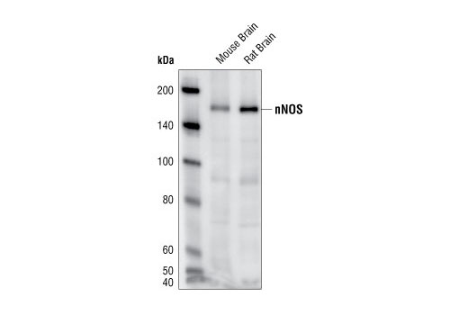 Western Blotting Image 1: nNOS Antibody