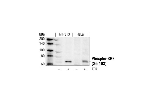 Western Blotting Image 1: Phospho-SRF (Ser103) Antibody