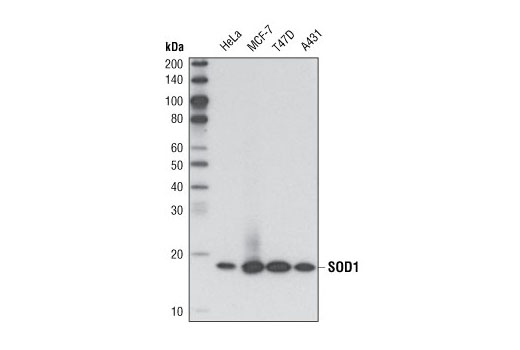  Image 7: Mitochondrial Marker Antibody Sampler Kit