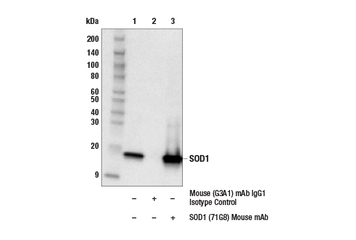 Immunoprecipitation Image 1: SOD1 (71G8) Mouse mAb