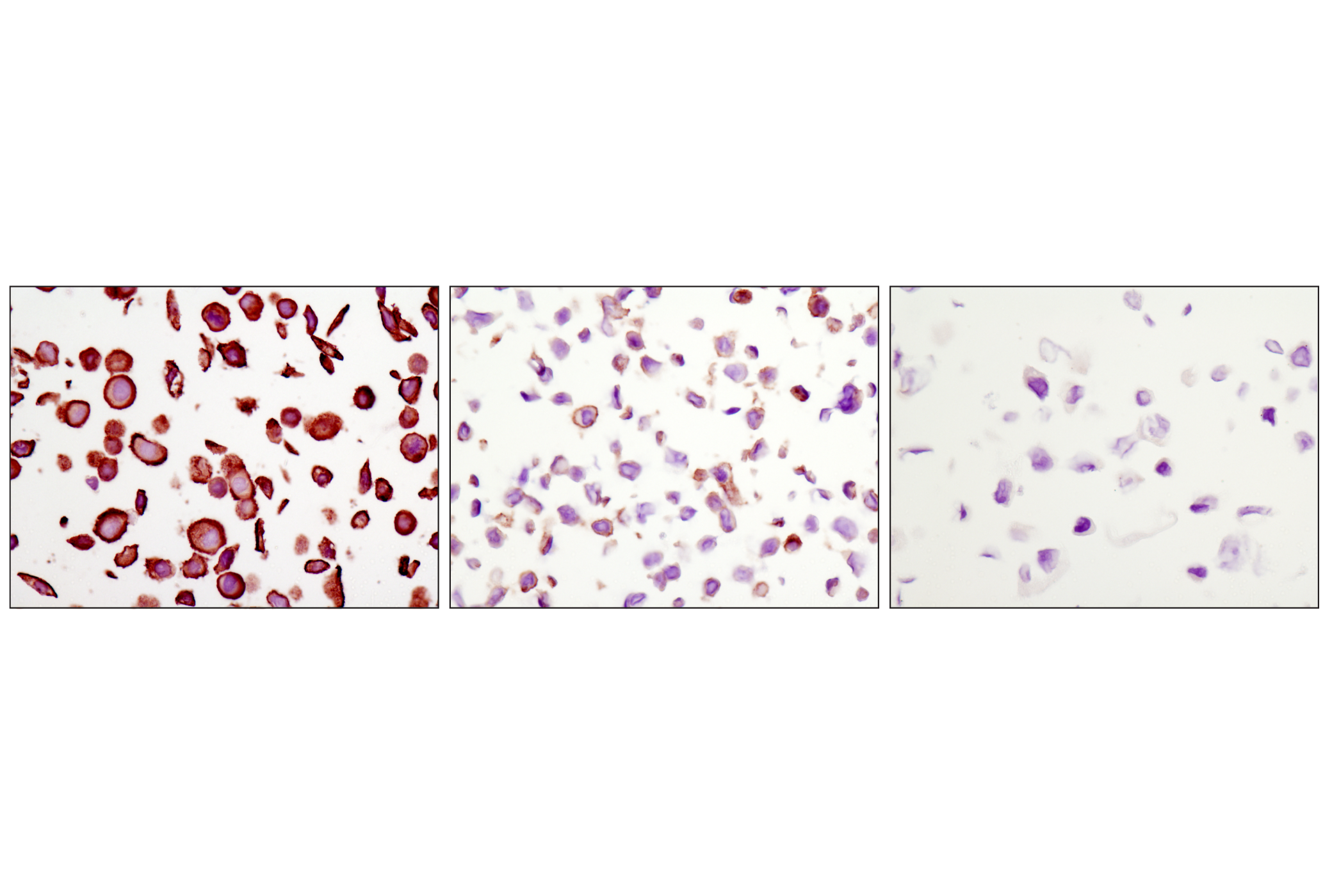  Image 49: HER/ErbB Family Antibody Sampler Kit