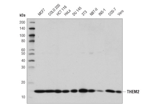 Western Blotting Image 1: THEM2 Antibody