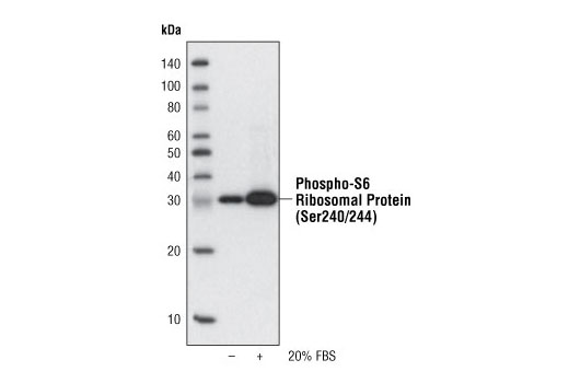 Western Blotting Image 1: Phospho-S6 Ribosomal Protein (Ser240/244) (61H9) Rabbit mAb (Biotinylated)