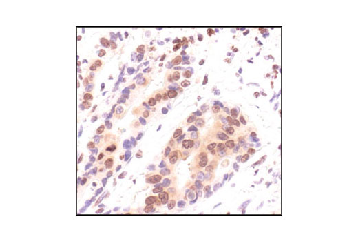  Image 21: Cell Cycle Regulation Antibody Sampler Kit II
