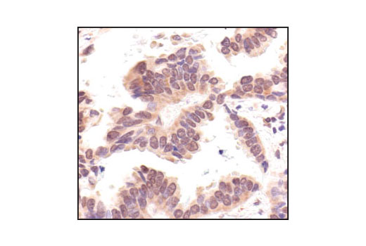 Image 24: Cell Cycle Regulation Antibody Sampler Kit II