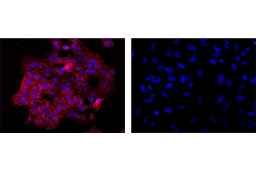 Immunofluorescence Image 1: E-Cadherin (24E10) Rabbit mAb (Alexa Fluor® 555 Conjugate)
