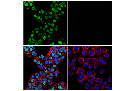 Immunofluorescence Image 1: ZHX2 (E5H5G) Rabbit mAb