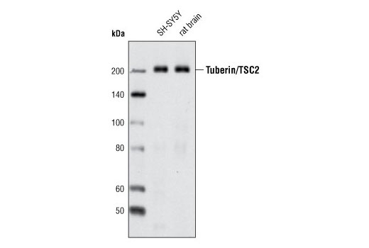  Image 4: Phospho-TSC2 Antibody Sampler Kit