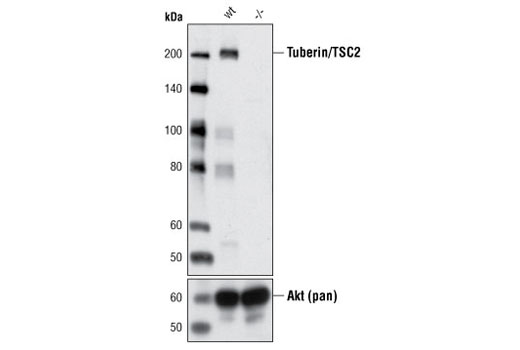  Image 7: Phospho-TSC2 Antibody Sampler Kit
