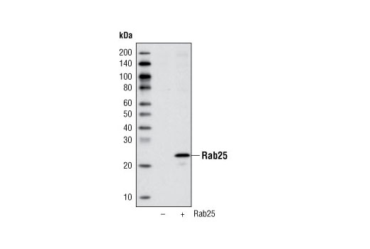 Western Blotting Image 1: Rab25 Antibody