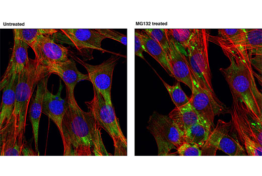 Immunofluorescence Image 1: FMRP Antibody