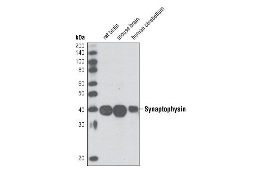 Western Blotting Image 1: Synaptophysin Antibody