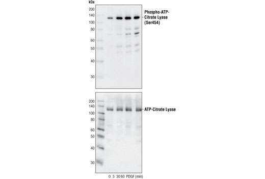  Image 7: Fatty Acid and Lipid Metabolism Antibody Sampler Kit