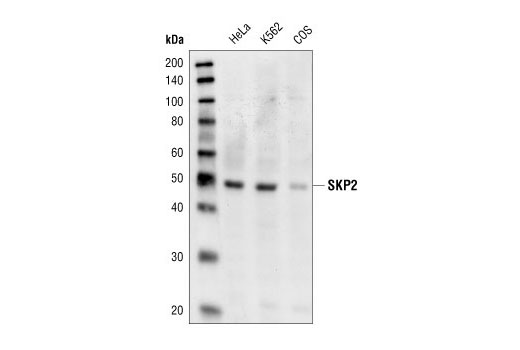 Western Blotting Image 1: Skp2 Antibody