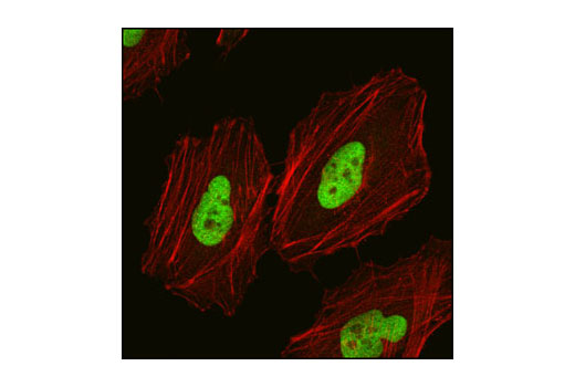 Immunofluorescence Image 1: Skp2 Antibody