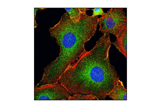 Immunofluorescence Image 1: IRAK1 Antibody