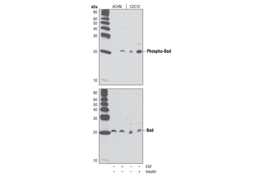  Image 3: Phospho-Bad Antibody Sampler Kit