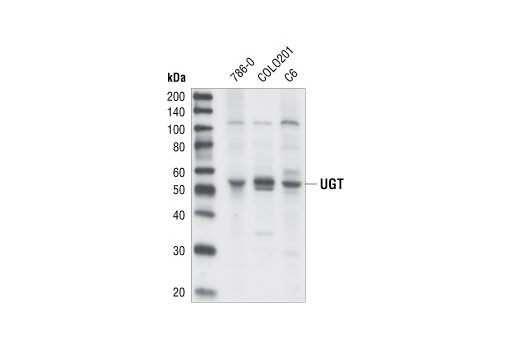 Western Blotting Image 1: UGT Antibody